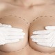 BreastAugmentationFI