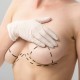 Types of Breast Lifts
