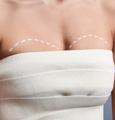 Tips for recovering from breast augmentation